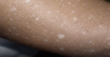 0cd18542 3e00 4a97 8e43 1a5ab4cd58c1 (1)