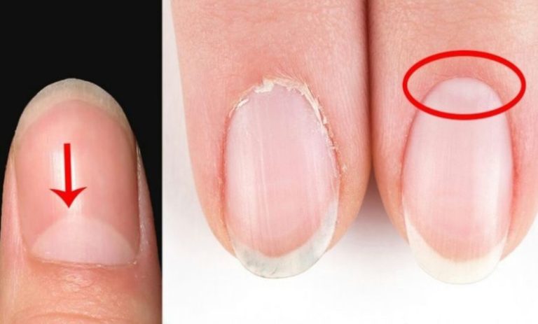 1 15 780x470 2 768x463