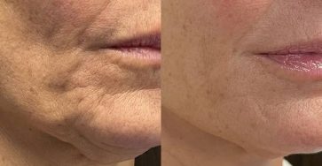 11533cbe0a1fc46f6742c9224b8732b7