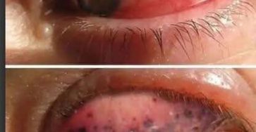 518148165 122225540864089999 5469876381188110129 n e1759393616988