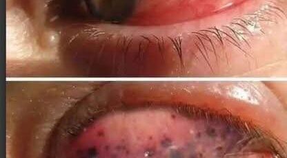 518148165 122225540864089999 5469876381188110129 n e1759393616988