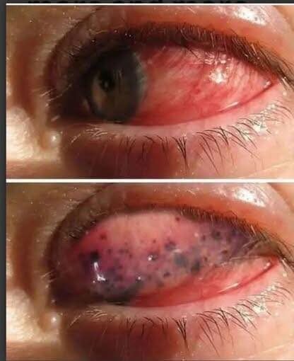 518148165 122225540864089999 5469876381188110129 n e1759393616988