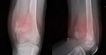 550994548 1219129146916736 765398586958315806 n