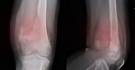 550994548 1219129146916736 765398586958315806 n