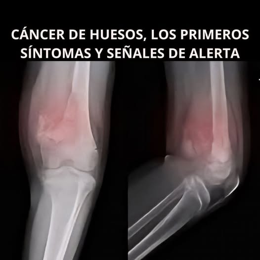 550994548 1219129146916736 765398586958315806 n