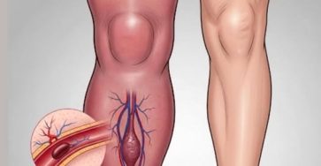 553688451 122217788942111867 612668514187809326 n