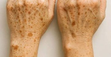 555628790 10237743052931951 1570253214771712980 n