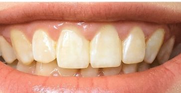 915ef902 0f94 48fe a890 82aed8308816