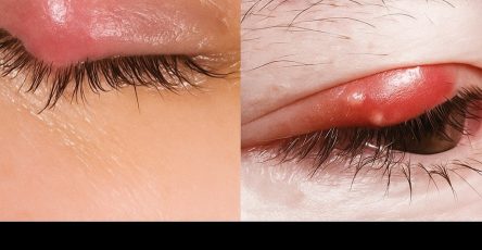 B96f6e45 d65c 4d95 9f9f 3018cd68238f