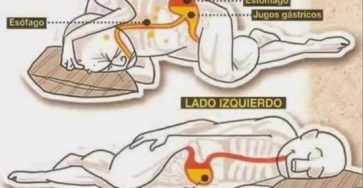 Desventajas de dormir del lado derecho