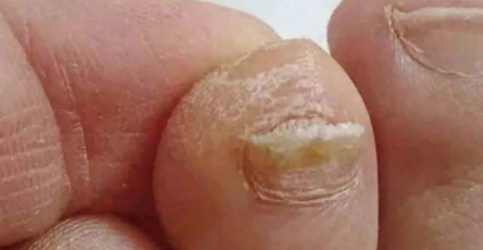 0f7b152a 114c 416c bae5 7f62cd851c7f