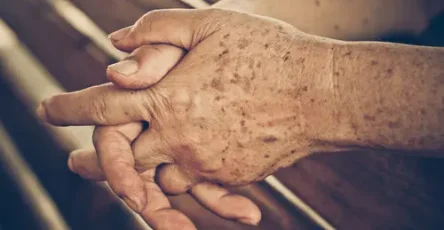 Eliminar las manchas la edad la piel