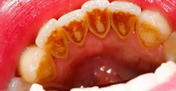Sarrodental 768x432