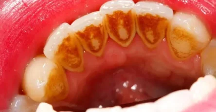 Sarrodental 768x432