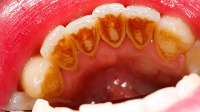 Sarrodental 768x432